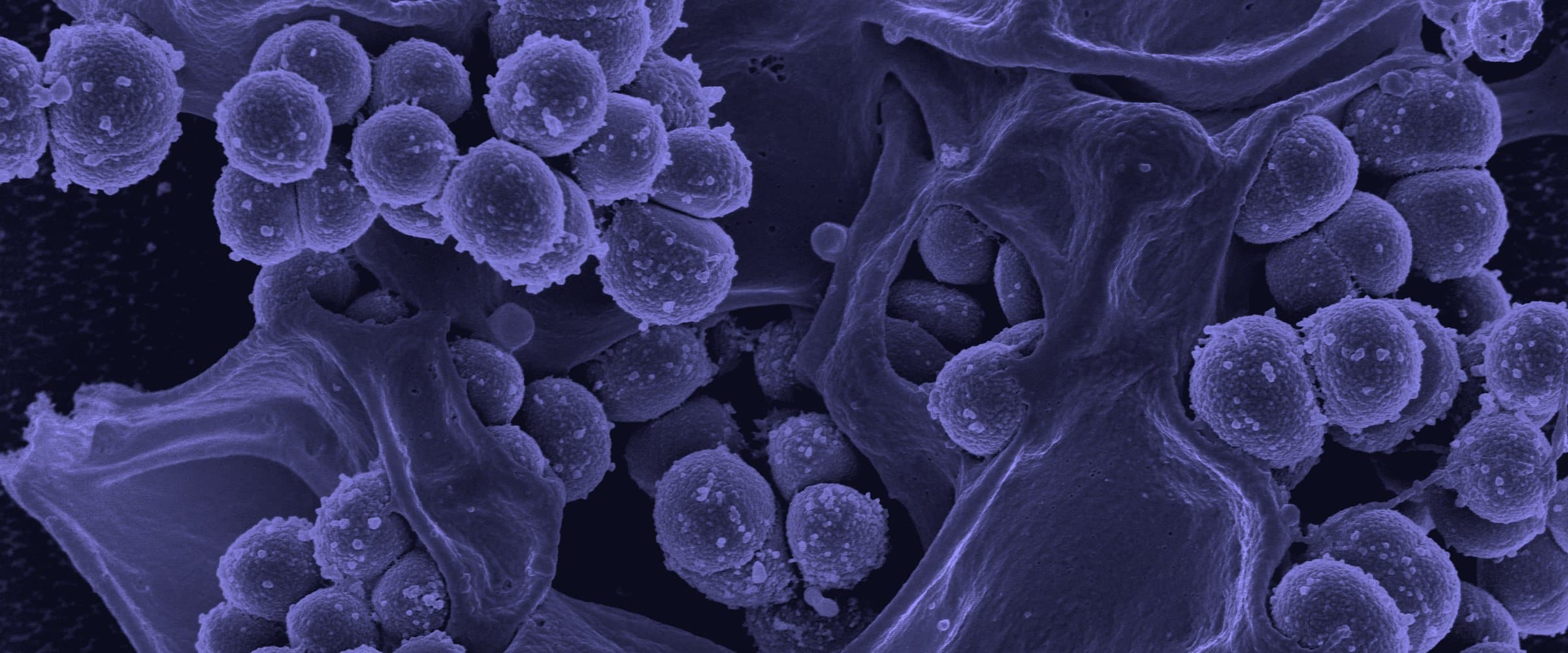 A colorized scanning electron micrograph of MRSA bacteria clustered on a human neutrophil.